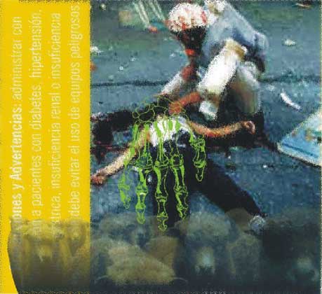 Imagen de la serie CARNE, de Juan Barbagelata