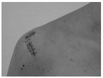 Calenco: Soy de carne